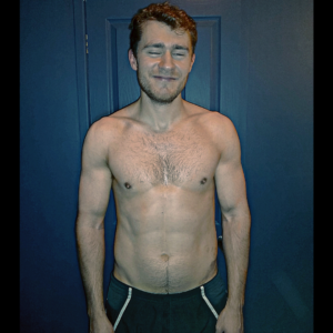 A PTLDN Body Transformation after photo